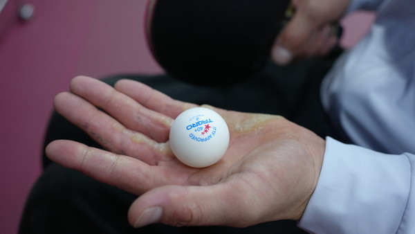 20년 넘게 탁구 연습과 경기로 굳은 살이 생긴 김정길 선수의 손.